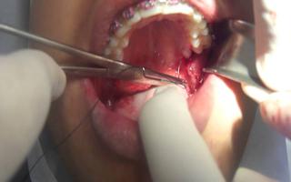 GOE - Ortodontia no Santo Agostinho - BH - Implantes Dentrios e Prteses  no Santo Agostinho - BH